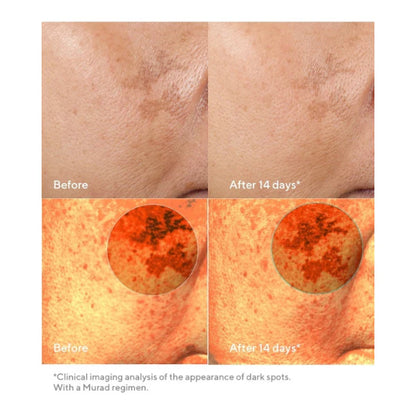 Rapid Dark Spot Correcting Serum