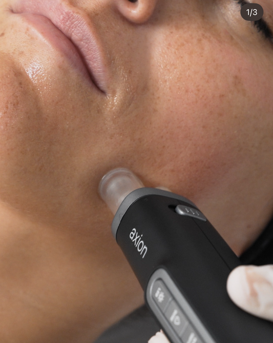 AXION Microneedling
