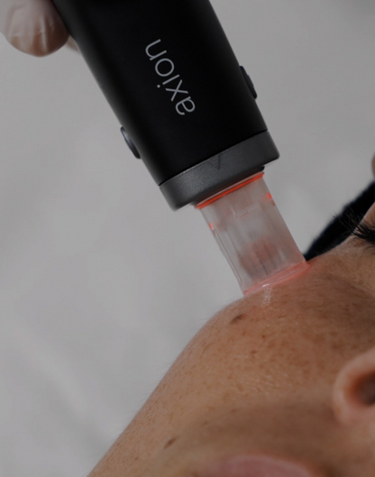 AXION Microneedling